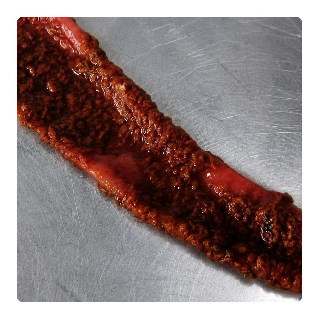 Close-up of a piece of raw red intestines on a metallic surface